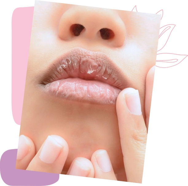 Revitalize Your Lips with Specialized Lip Treatments