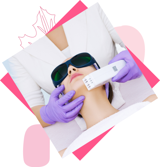 Laser Hair Removal chin